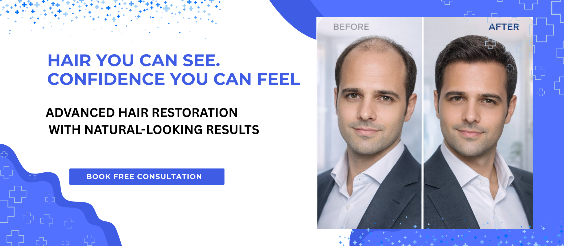 Banner 2 - Restoring hair, renewing confidence